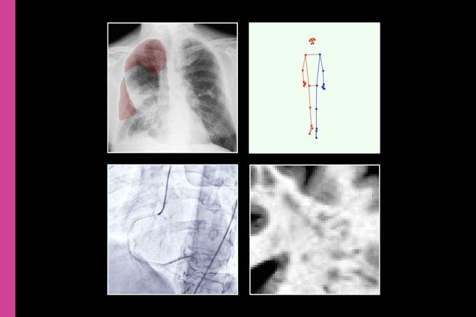 A graphic showing four scans and medical images.