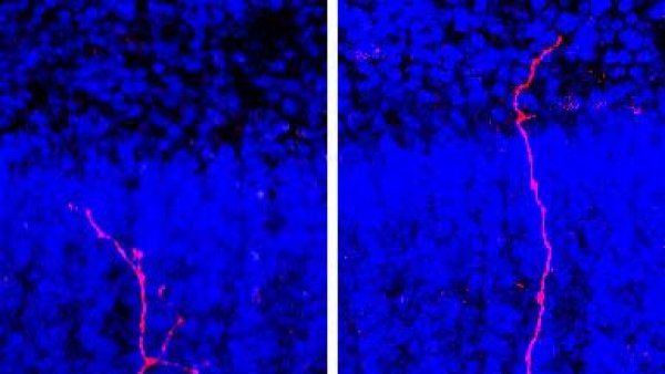 Microscope image of human cortical neuron.