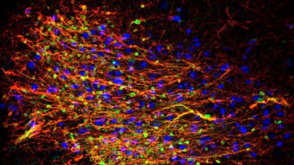 Immature amygdala neurons