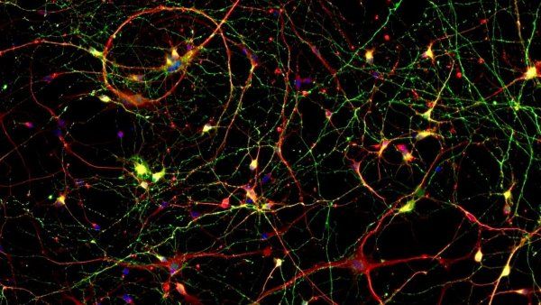 tau shown in brain