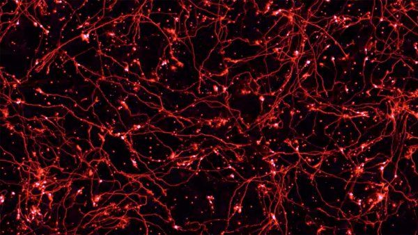 microscopic image of neurons