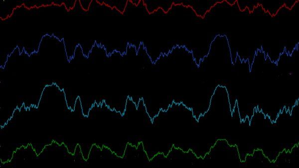 Delta brain waves