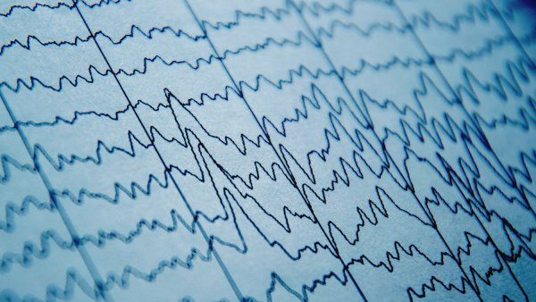 EEG patterns on paper