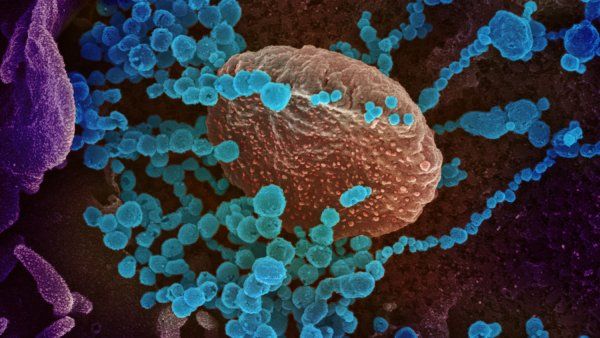 Microscopic image of the new coronavirus, SARS-CoV-2, emerging from cell