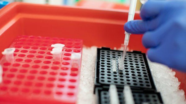 samples pipetted in preparation for a PCR test