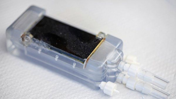 Artificial kidney prototype