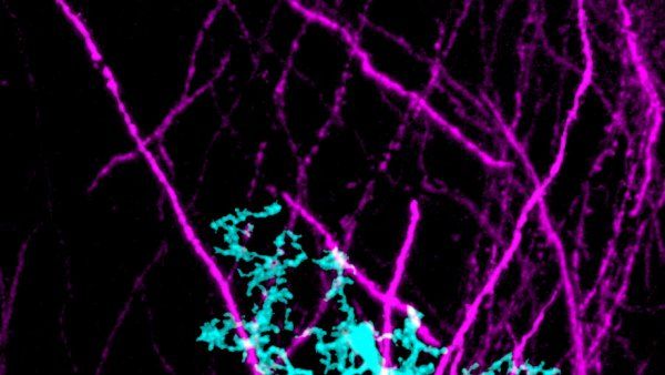 microscopic image of microglia surrounding dendrites in the hippocampus