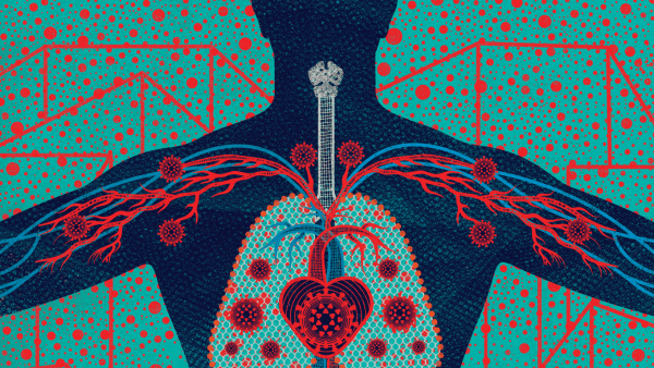 Illustration of the inside of a body, with coronavirus cells throughout.