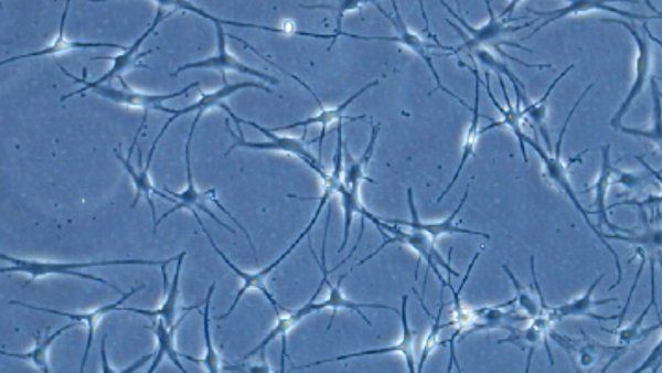 Melanocytes shown in a microscopic view of tissue culture