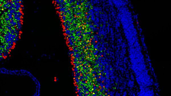 Microcopic image of mouse brain with cells colored in red, yellow, green, and blue