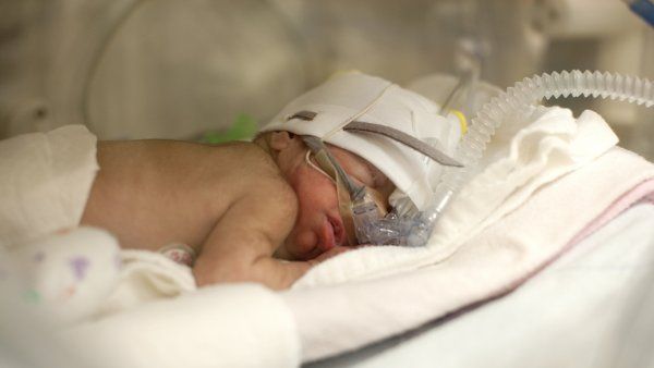 Premature baby in incubator 