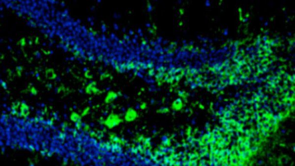 Concentration of tau tangles (in green), a phenomenon associated with Alzheimers, in the brains of mice without FNSS genes