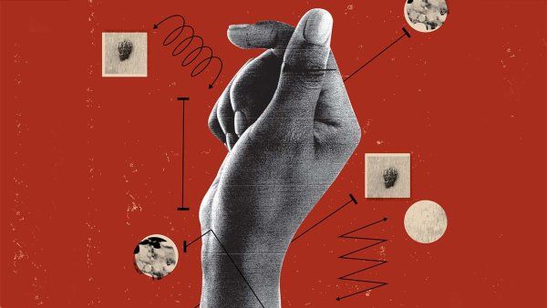 Photo illustration of a dark skinned hand; around the hand are arrows and examples of skin conditions.