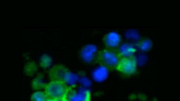 Microsopy of CAS9 and IL2RA