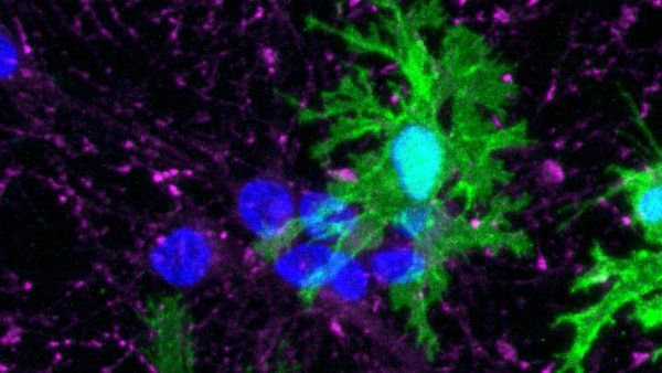 Microscopic image of microglia (green) derived from human stem cells by members of the Kampmann lab. 