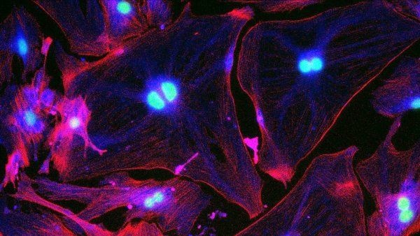 A group of senescent cells are ligt up in flurescent fuscia and blue