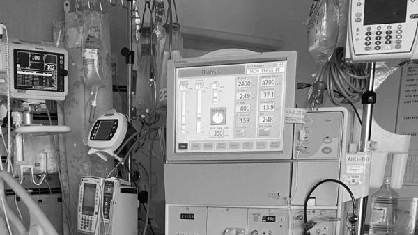 A dialysis machine in a hospital.