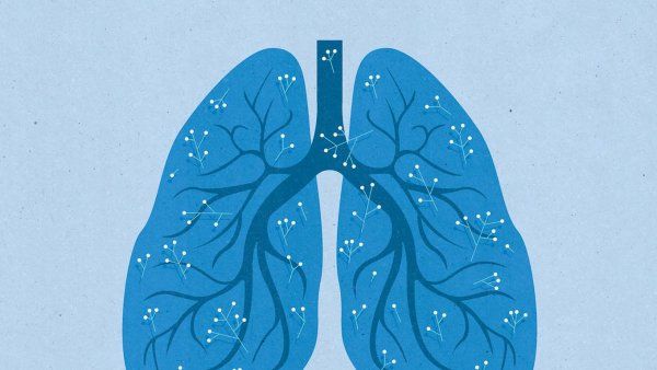 Illustration of lungs.