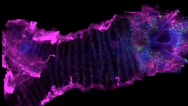 A microscopic image showing neuroendocrine cells near a neuron.