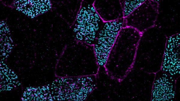 A microscopic image of multiciliated lung cells.