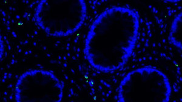 A microscopy of lingering COVID-19 virus (green) among cells in the gastrointestinal tract (blue).