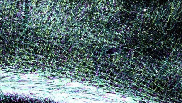 A microscopy showing illuminated myelin in the brain.