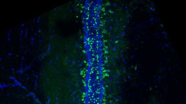 A microscopic image of cerebrospinal fluid-contacting neurons lining the central canal along the spinal cord.