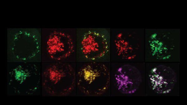 Microscopic image of a set of cells engineered with TGF-beta SNIPRs.