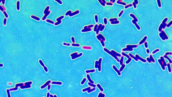 A microscopic image of the bacteria Lactobacillus.