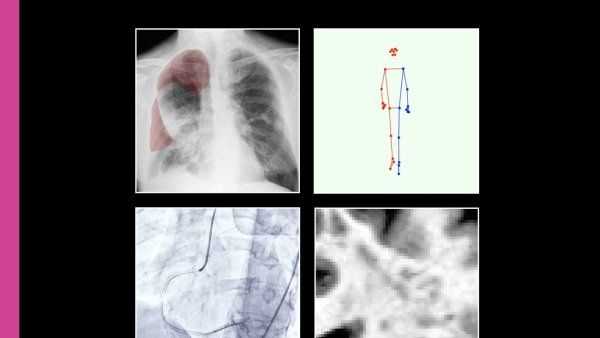 A graphic showing four scans and medical images.