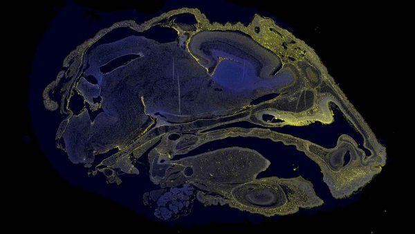 A microscopic image showing the biodistribution of therapeutic molecules in the brain of a fetal mouse, showing in yellow.