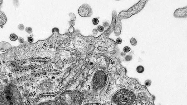 aids in process hiv infection of human lymphoid cd4-t cells