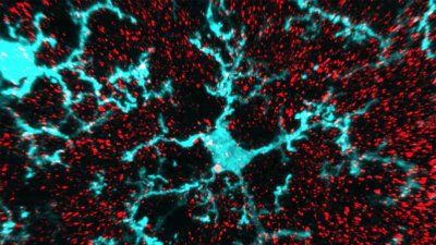Digital_rendering_microglial_cell.jpg
