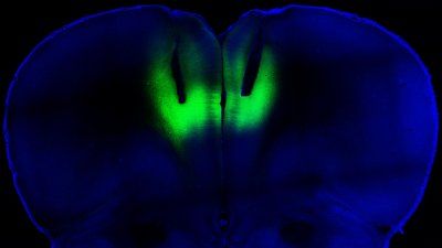 scan of prefrontal cortex