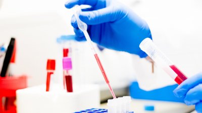 lab_work_detail.jpg