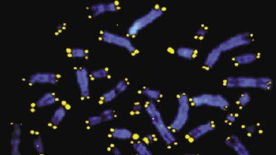 telomere_400.jpg