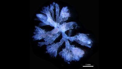 Science_in_Focus_Placenta.jpg