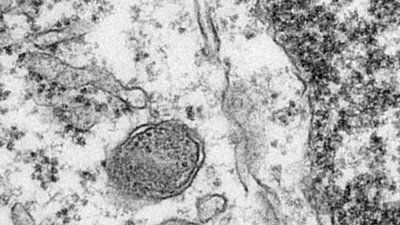 electron-micrograph-zika.jpg