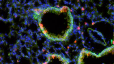 epithelial_cells.jpg