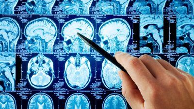 examining_brain_scans.jpg