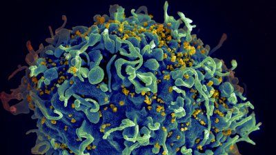 hiv_03_infected1_full.jpg