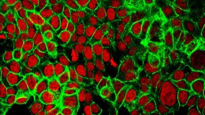 human_colon_cancer_cell_NIH.jpg
