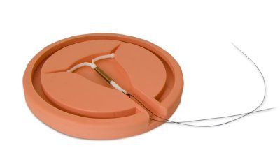 iud_contraception_2.jpg