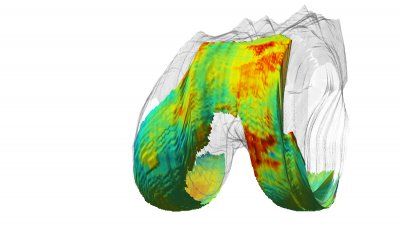 qmri-knee-joint.jpg