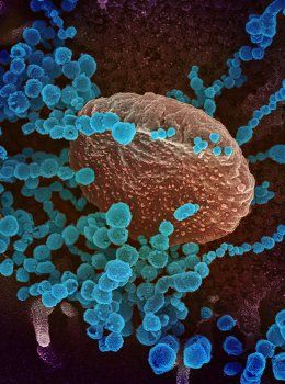 novel coronavirus microscopy