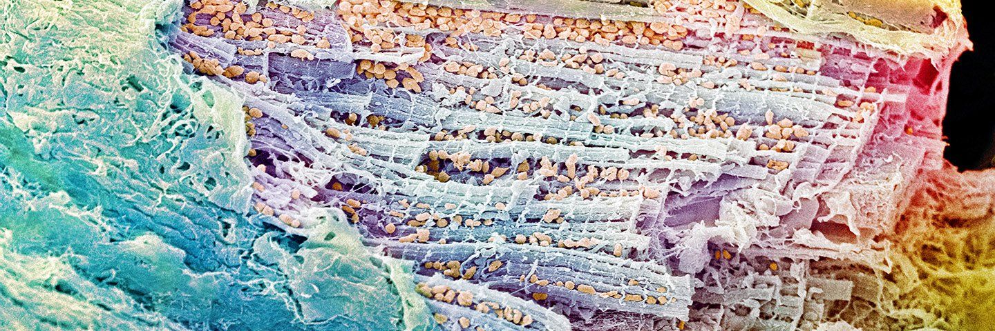 A magnified and multicolored lattice of heart tissue